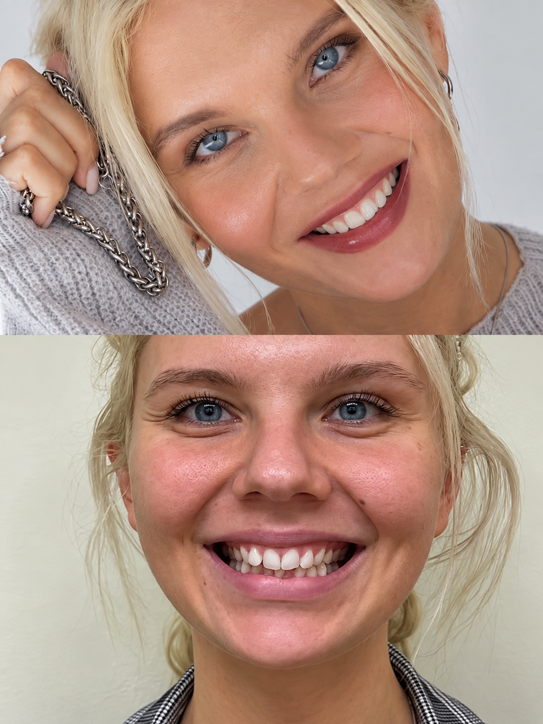 Marta Rudat DDS — A smile transformation showing how thoughtful treatment planning can create a result that feels natural to the individua